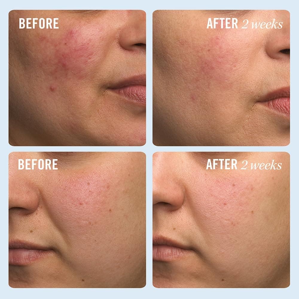 Gurayz, Aid Beauty, Hydration Daily Moisturiser