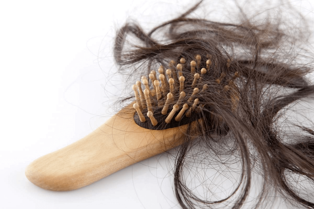 Understanding the Unique Struggles of Female Hair Loss 1 female hair loss, gurayz,