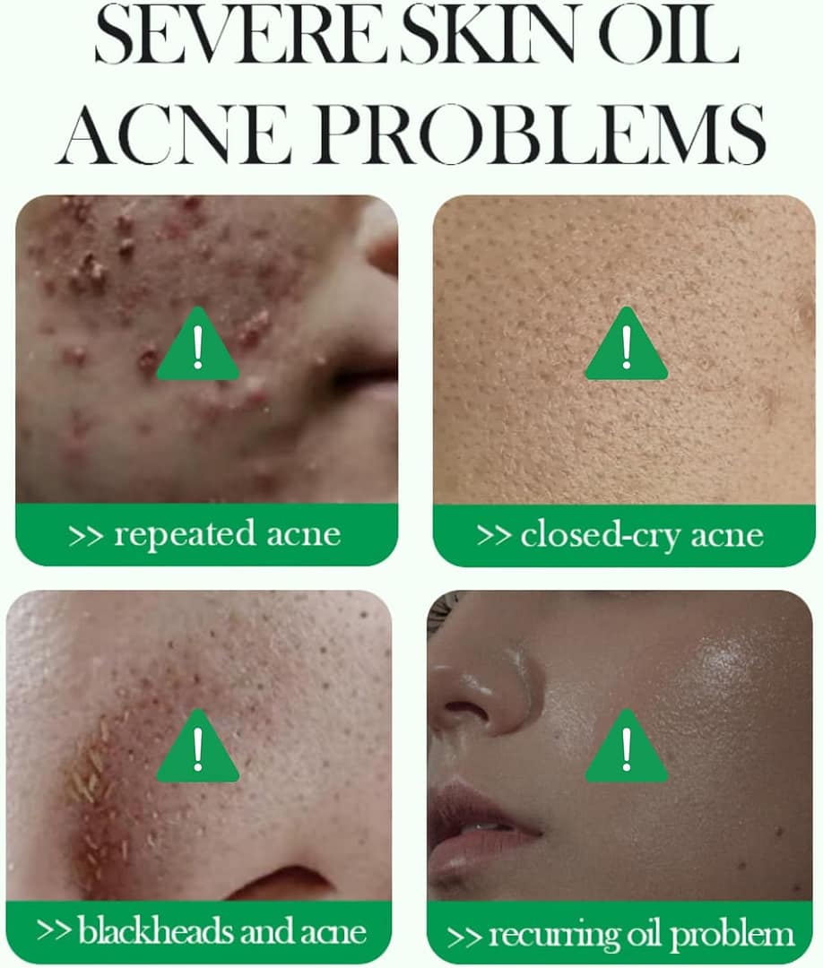 Gurayz, Cleansing Oily Skin, Large Pores, skincare.
