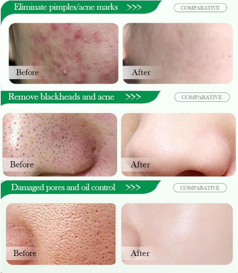 Gurayz, Cleansing Oily Skin, Large Pores, skincare.